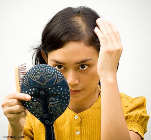 All about Hair Loss