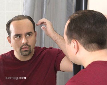 Repopulate Your Scalp Affected by Hair Loss